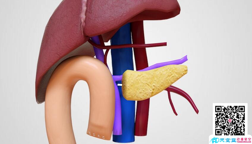 胰腺癌根治術動畫視頻