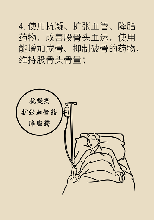 激素會(huì)帶來(lái)股骨頭壞死的后遺癥嗎？