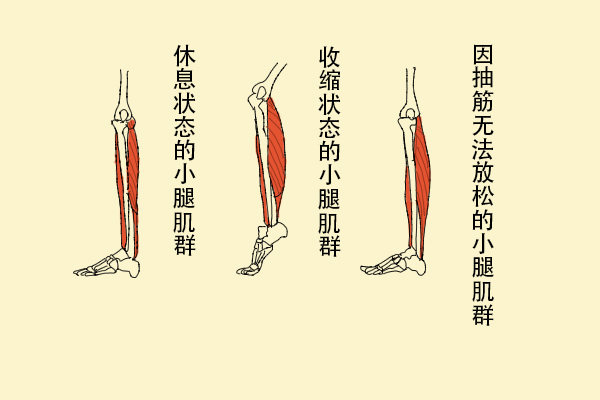 為什么缺鈣會導(dǎo)致抽筋？