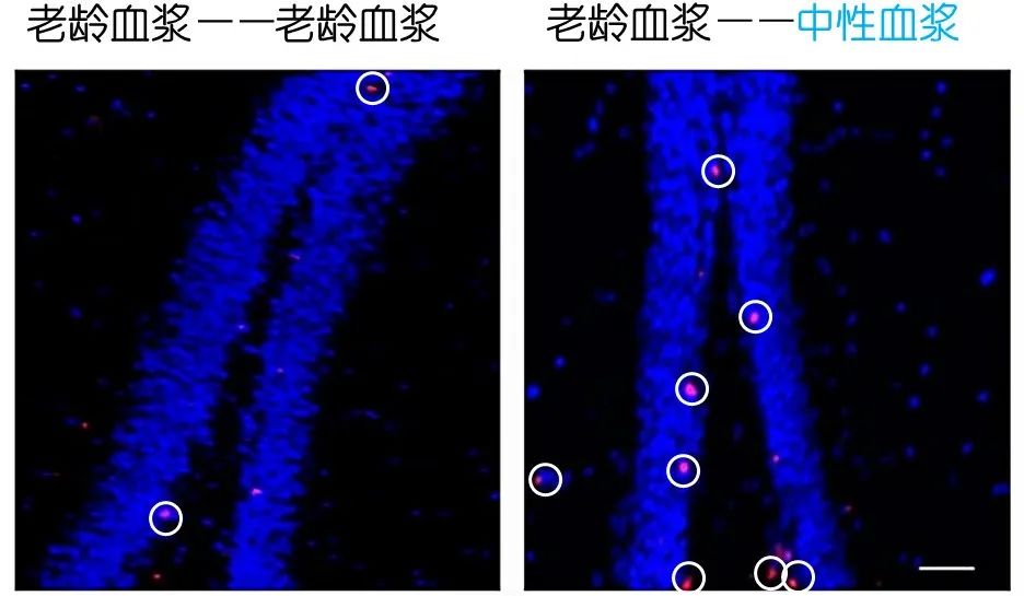 重返年輕不用大換血，只要給血液“兌點(diǎn)水”？