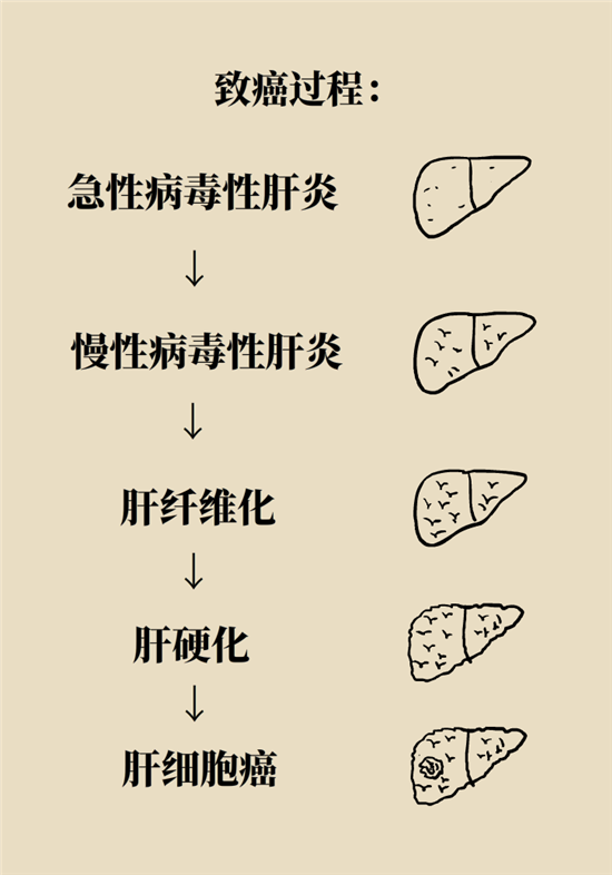 癌癥會傳染嗎？專家：這些高危因素得注意