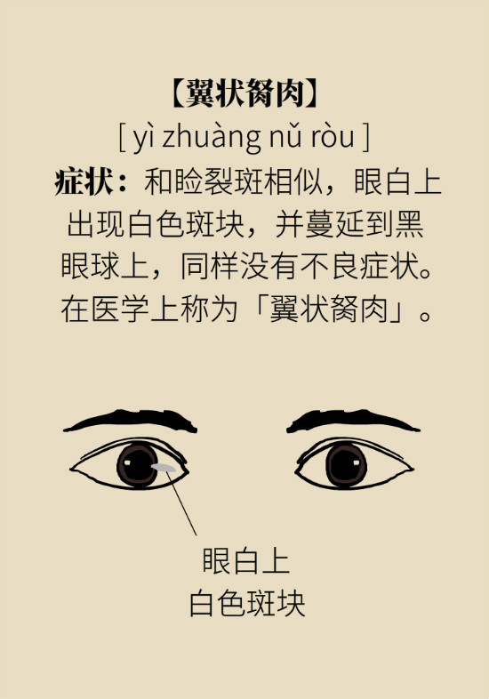 眼白有斑塊、出血要緊嗎？專家：名字唬人但問題不大