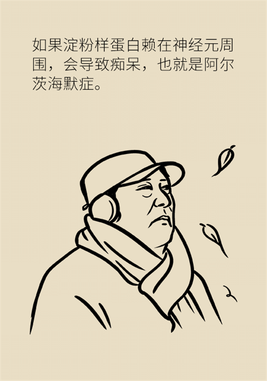 身體出現(xiàn)這些癥狀要小心，可能是腦出血發(fā)出的信號(hào)