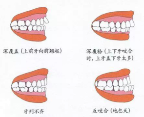 兒童換牙常見3大問題，保護牙齒需要做好這5點