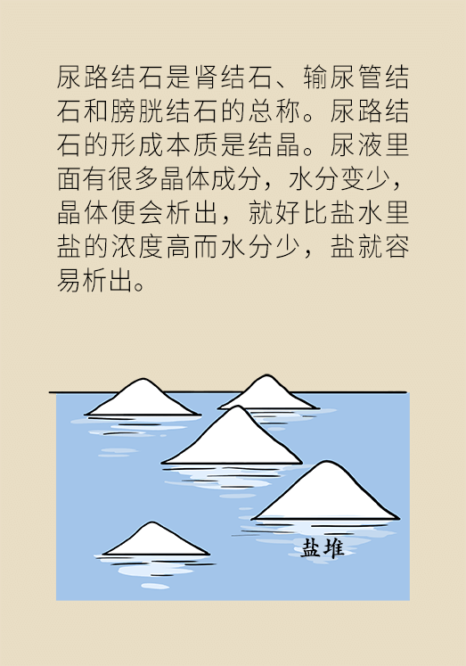 結(jié)石科普動漫制作