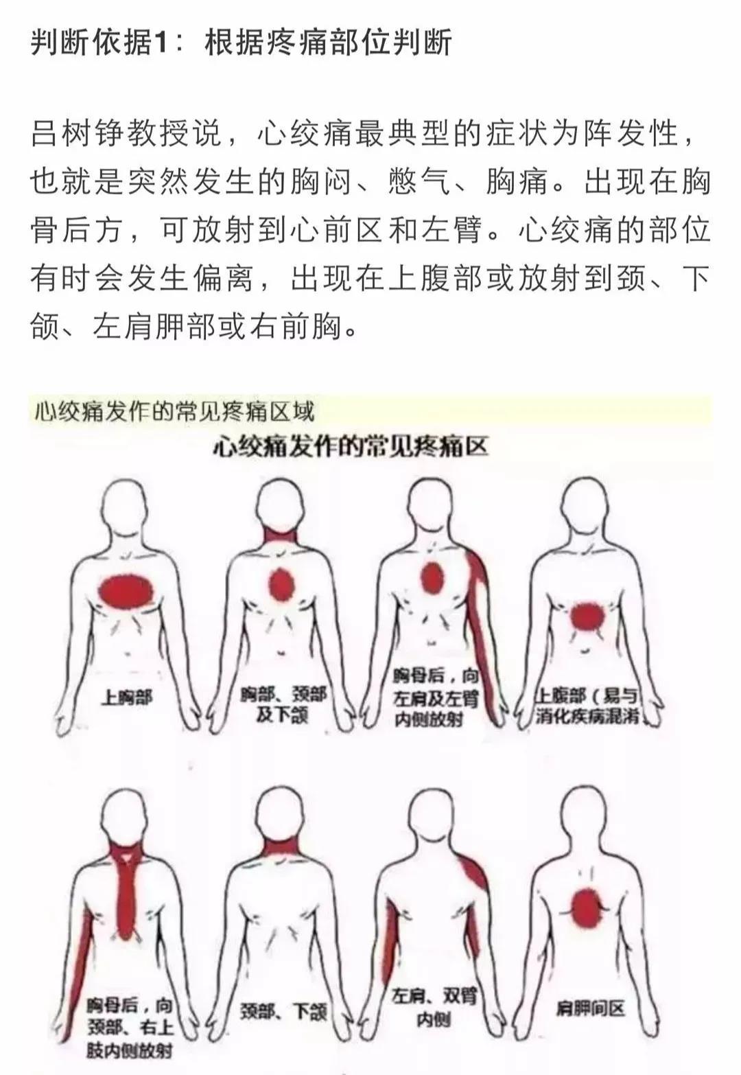 心梗有前兆！心臟發(fā)出的警報(bào)你在意了嗎？