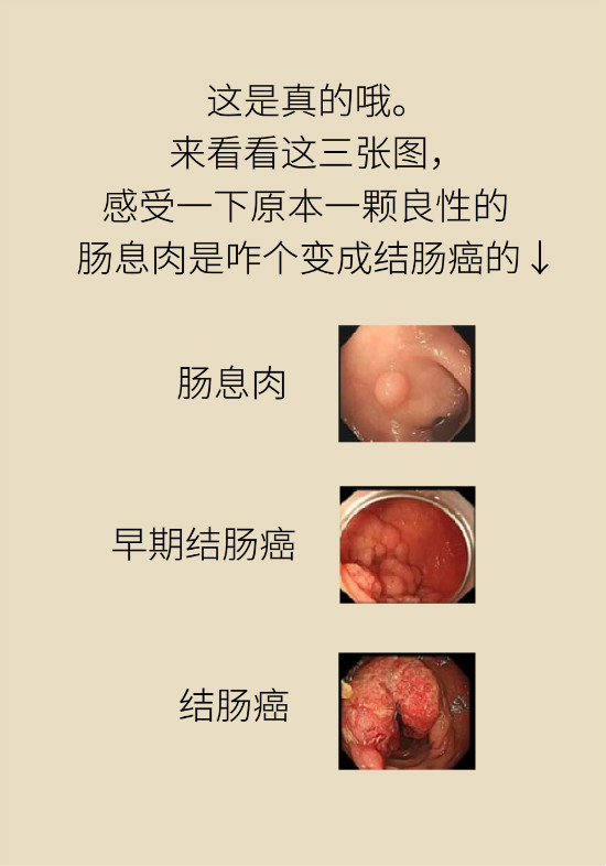 大腸癌科普動漫制作