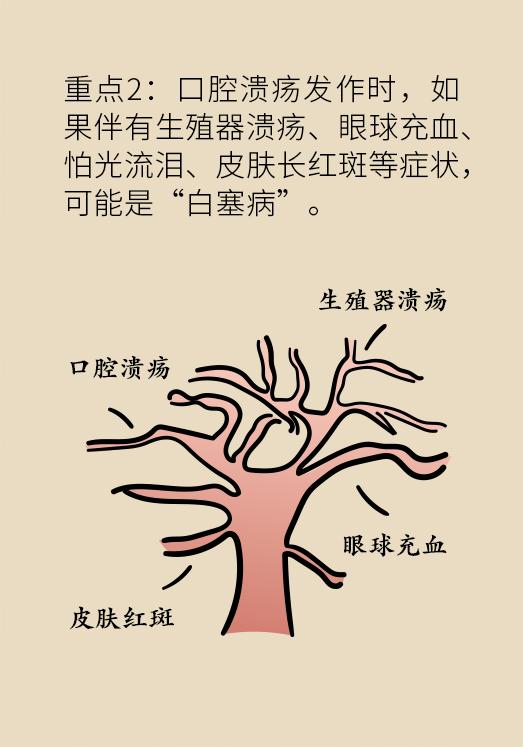 口腔潰瘍醫(yī)學(xué)知識(shí)科普動(dòng)漫制作