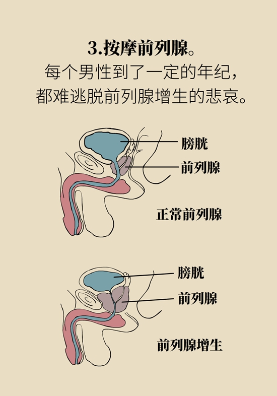 怎么做可以預(yù)防痔瘡呢？按摩前列腺、鍛煉盆底肌