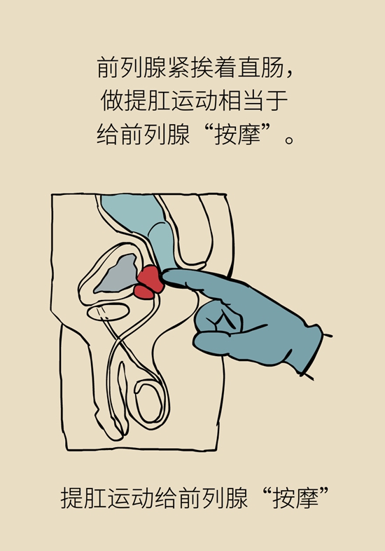 怎么做可以預(yù)防痔瘡呢？按摩前列腺、鍛煉盆底肌