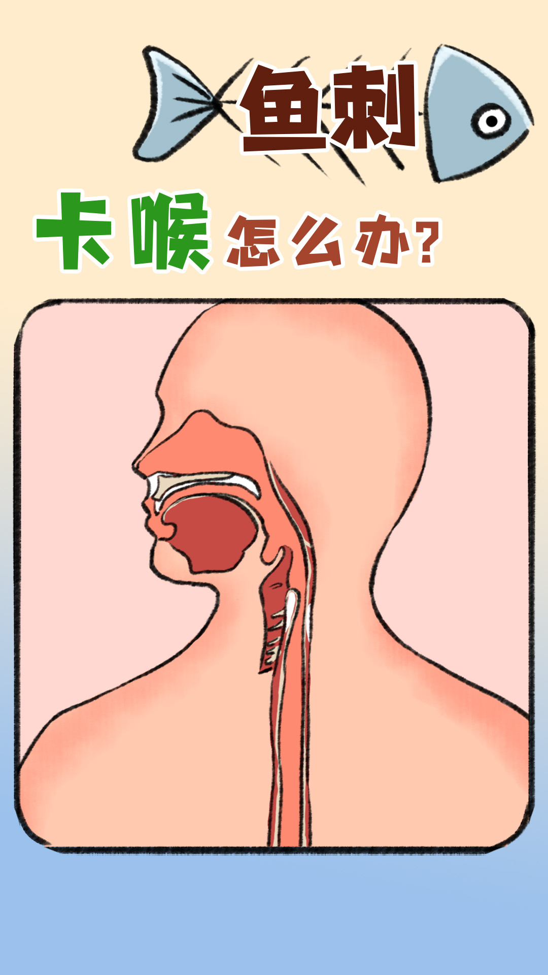 33魚刺咔喉怎么辦標題0328(1).jpg